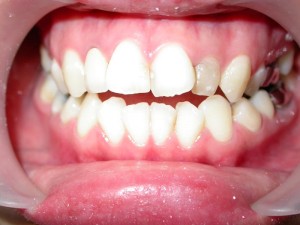 dente-smile-clinic-002
