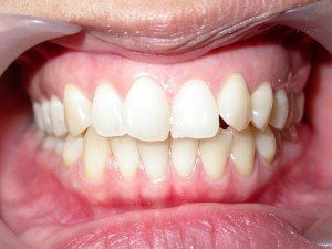 dente-smile-clinic-003