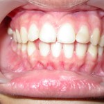 Dental Oral Surgery