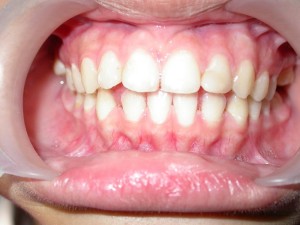 dente-smile-clinic-008