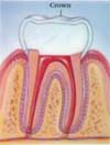 Dental Root Canal / Endodontic